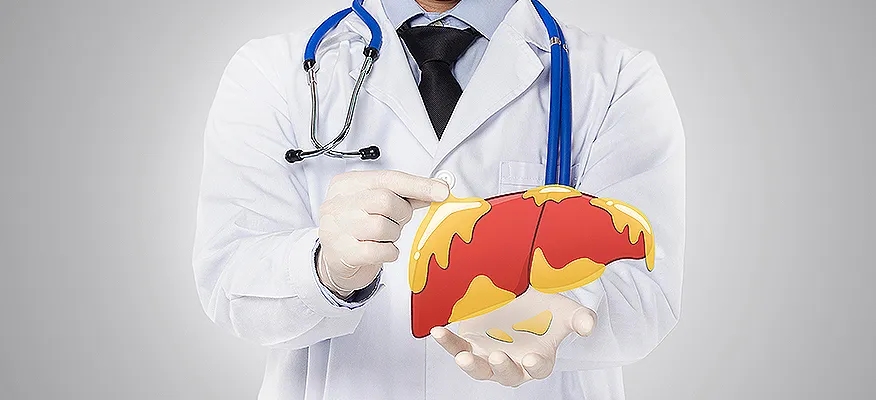 fatty liver disease